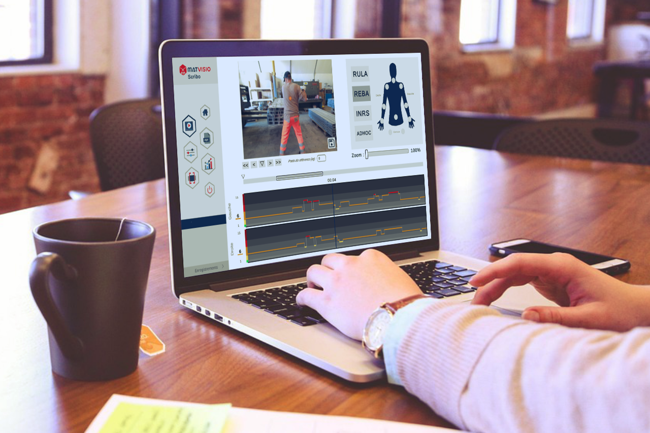 Etape 2 du programme MEASANA : Le logiciel MATVISIO en action, visualisation des données posturales.